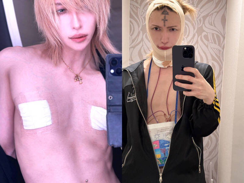 日本吉他手切掉奶头且称“男人不需要” 再削脸骨“啃自己骨头”