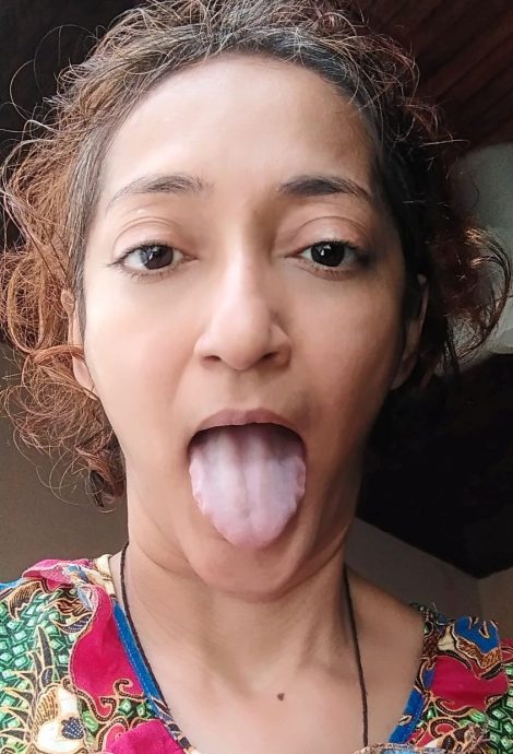 曾因长期冠病痛不欲生 记者:我挺过来了