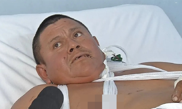 美洲豹闯农场飞扑啃咬　男工人“身上手机突然爆炸”意外救命