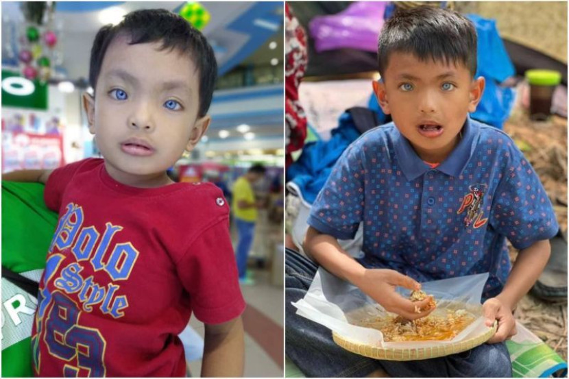 视频|9岁丹州男孩湛蓝双眸 网民：“五条悟”传人