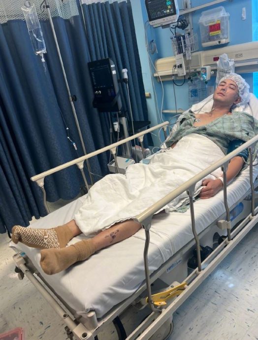 陈学冬晒第3次手术 头发全白吓坏网