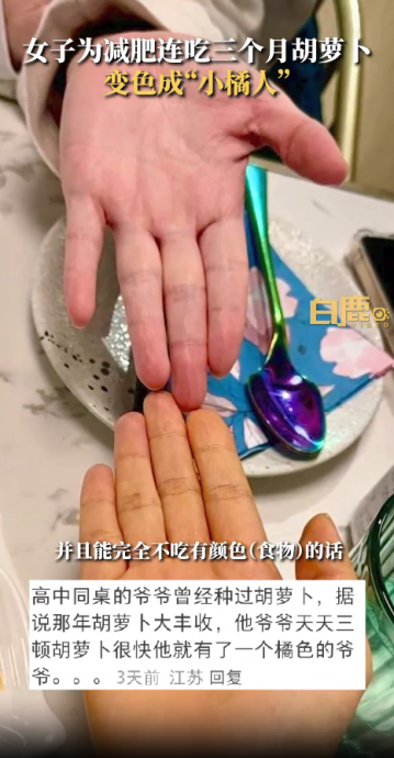 为减肥连吃3月红萝卜 女子被“染色”变小橘人