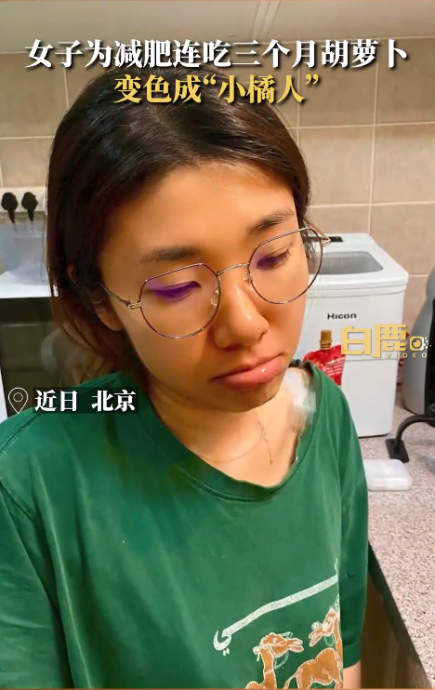 为减肥连吃3月红萝卜 女子被“染色”变小橘人