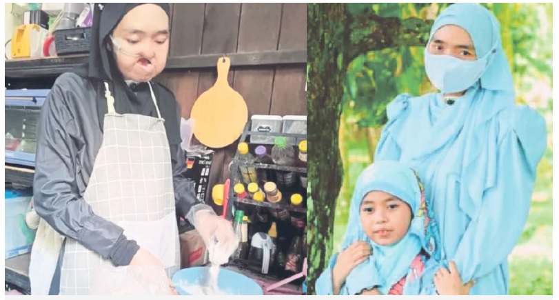 癌夫病逝又患口癌　寡妇咬紧牙根抚养女儿