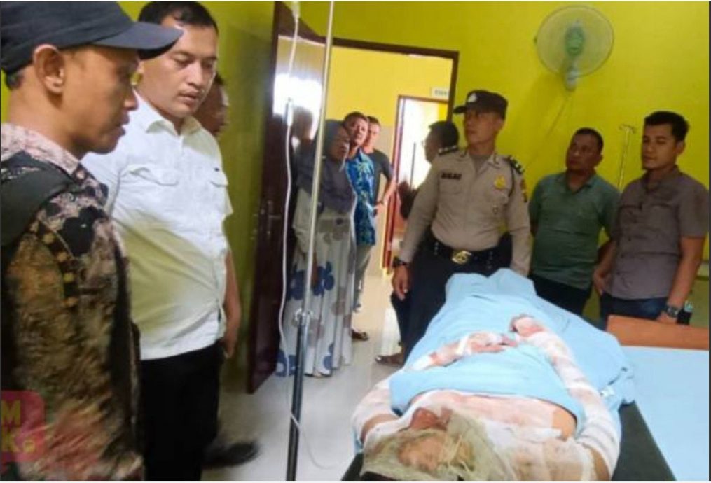  被醋夫疑红杏出墙  娇妻惨遭烧毁容