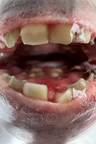 长满人牙的鱼!父亲钓获羊头鲷 女儿要收藏牙齿