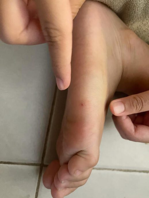 （已签发）柔：狮城二三事：阿嫂申诉邻居为阻走廊玩闹 撒玻璃碎割伤儿