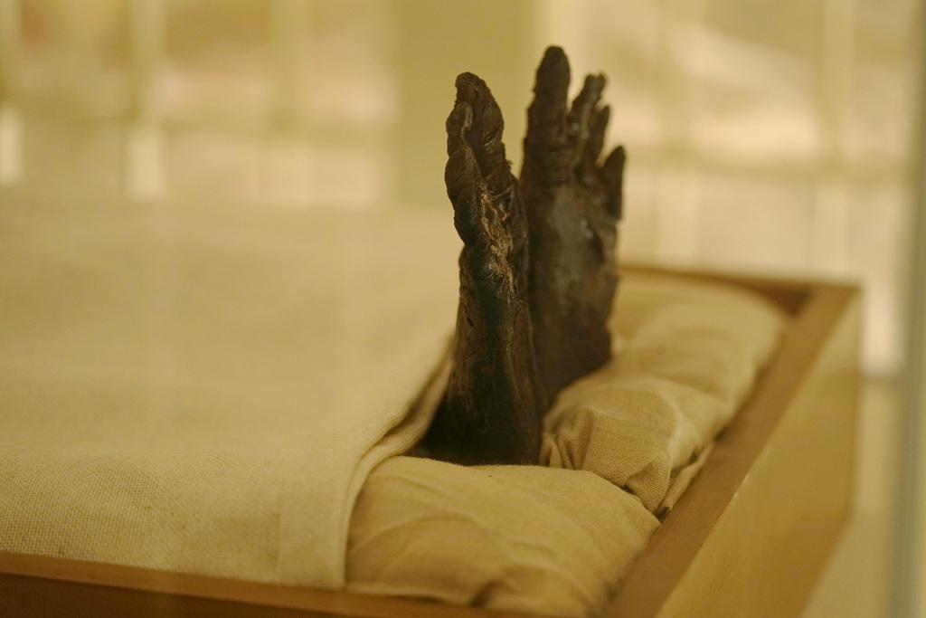 亲眼见过图坦卡门尸身 专家揭“缺陷”异状