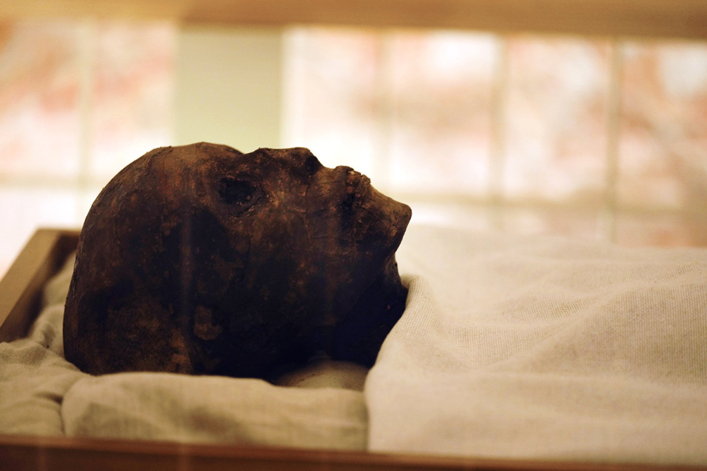 亲眼见过图坦卡门尸身 专家揭“缺陷”异状