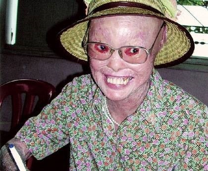 森州淡边新村穿山甲人张四妹走了！