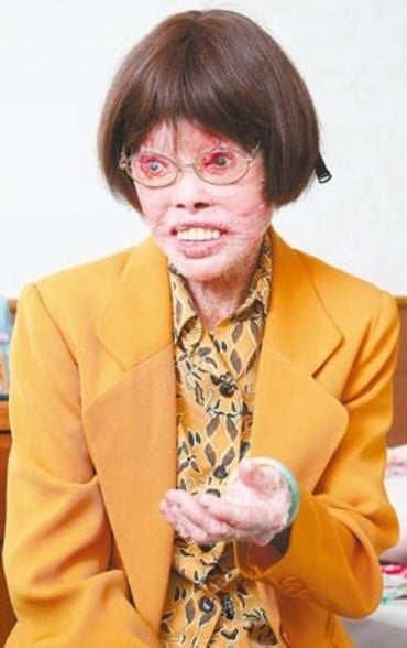 森州淡边新村穿山甲人张四妹走了！