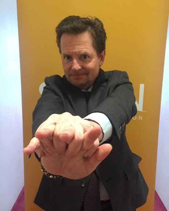 患柏金逊症不慎跌伤 《回到未来》男星险截肢保命