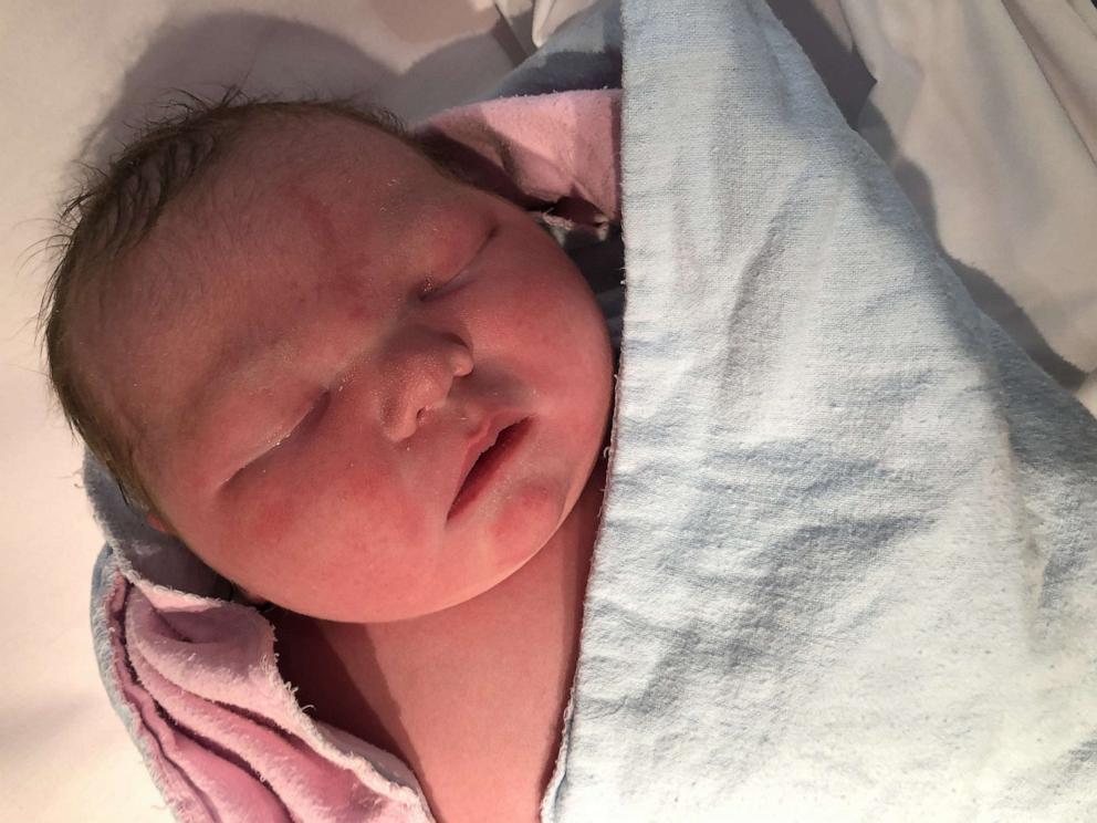 拼盘 加拿大6.6公斤巨婴诞生 体型就像3个月大婴儿