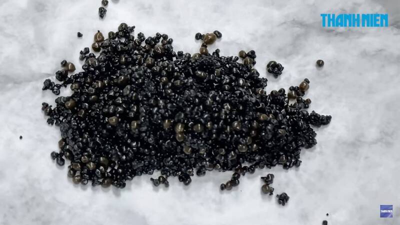 越南29岁男子腹痛送医 开刀后竟取出3200颗胆囊结石