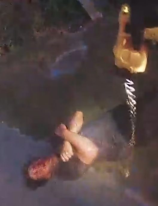 车祸满脸血无法呼吸　男子反遭警电击上铐