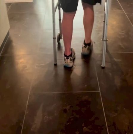 鹰眼遭辗断30根骨头 10个月后跑跳自如泪谢家人