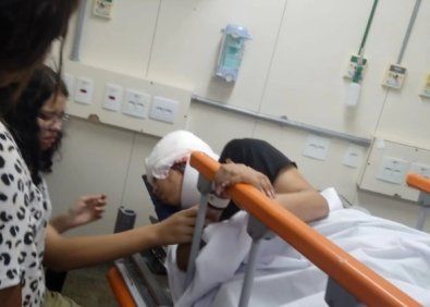 少女玩卡丁车“长发被引擎吃掉”　头皮遭活活剥下！恐脱发一辈子