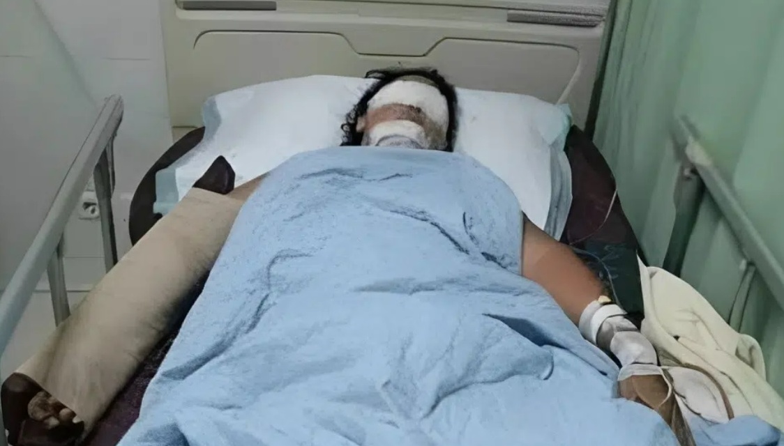 结婚两年被家暴 妻被躁夫打致失明 牙齿脱落又断手