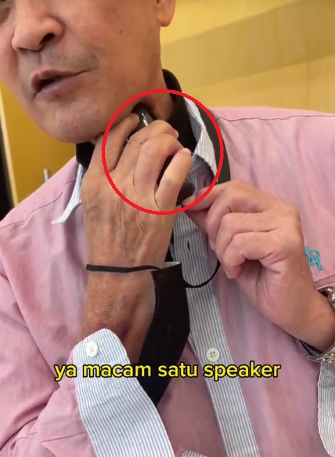 视频| 吸烟致癌切声带 “13年挂着电子喉说话”