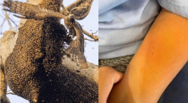 视频|一家在度假村被蜜蜂蛰伤 女子：是野鸟惹的祸！