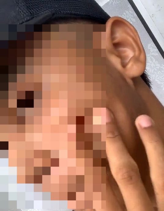 视频|滤镜太多 男子首次约会被女骂“原来满脸痘痘!”