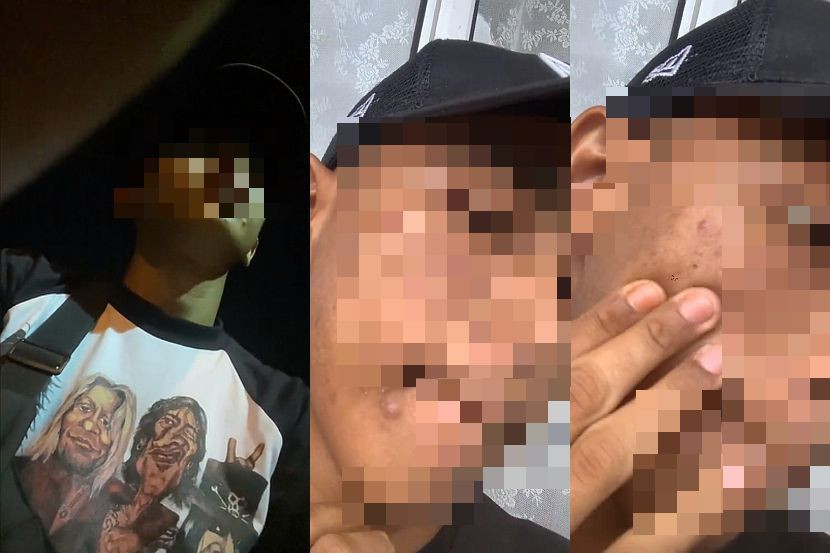 视频|滤镜太多 男子首次约会被女骂“原来满脸痘痘!”