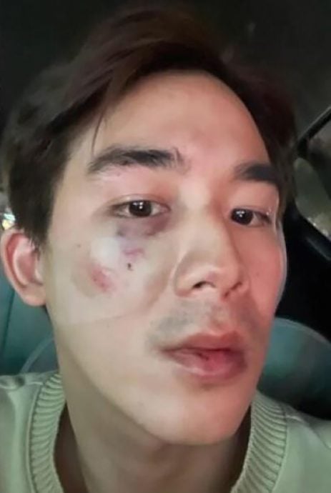 (已签发)柔:狮城二三事:“儿子”李博翔街头挨揍 李国煌:公道自在人心