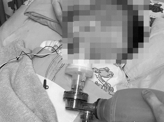 3天摔14次害男婴永久脑损 恶保母判监9年半