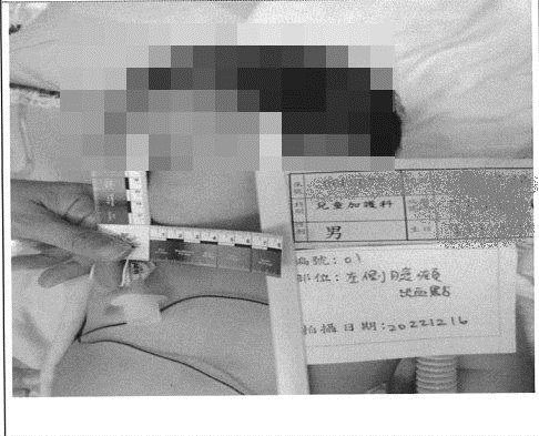 3天摔14次害男婴永久脑损 恶保母判监9年半