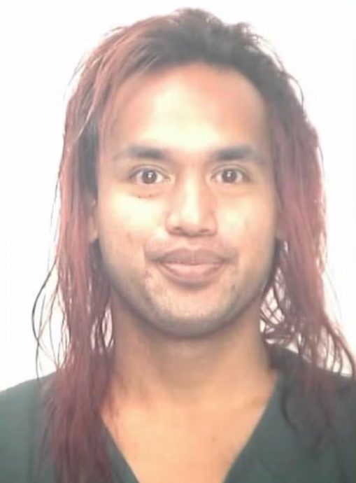 中国女教师在美被泼化学液体 嫌犯前一天才出狱