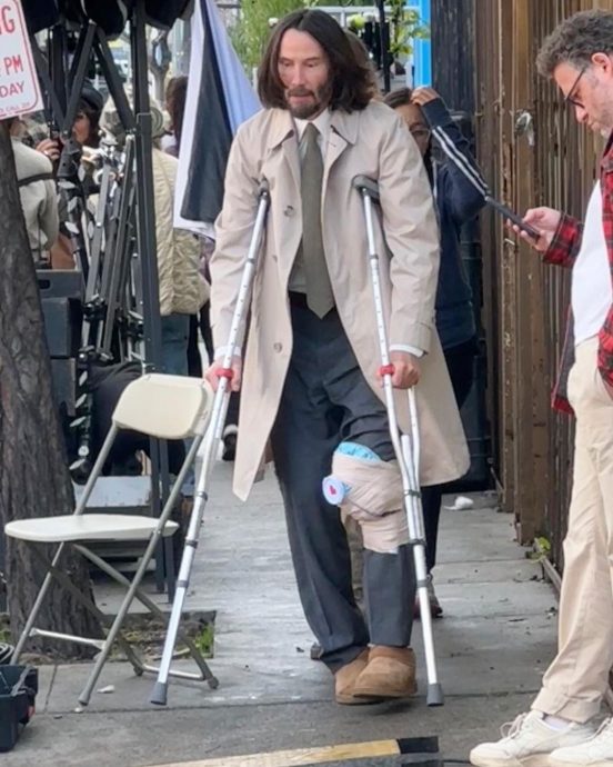 奇洛李维斯片场拄拐杖行走 膝盖绑冰袋