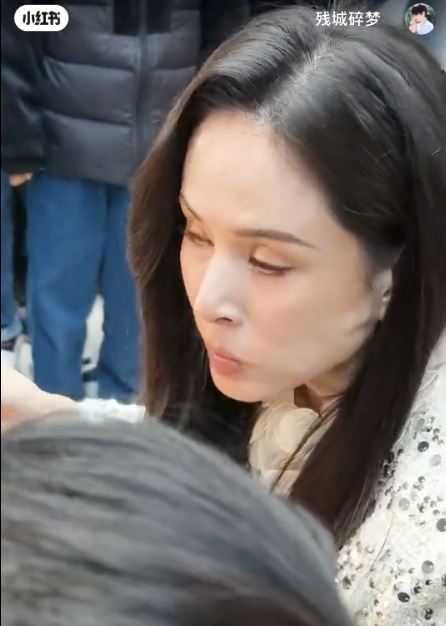 脸颊凸起被疑过医美 李若彤曝罹怪病没得医