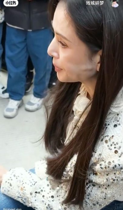 脸颊凸起被疑过医美 李若彤曝罹怪病没得医