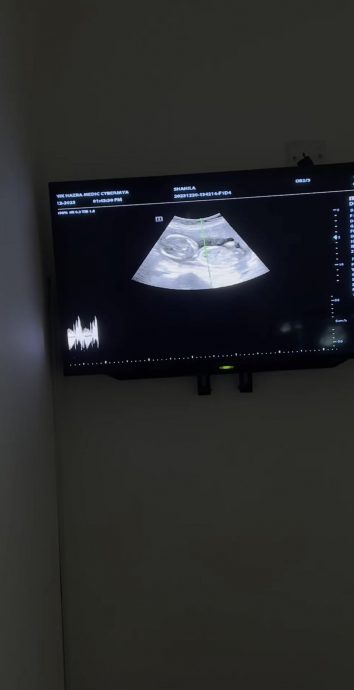 茜拉再婚报喜怀孕 与小8岁老公迎爱的结晶