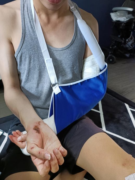 (已签发)柔:狮城二三事:电动脚车撞路坑 准新郎抛飞骨折