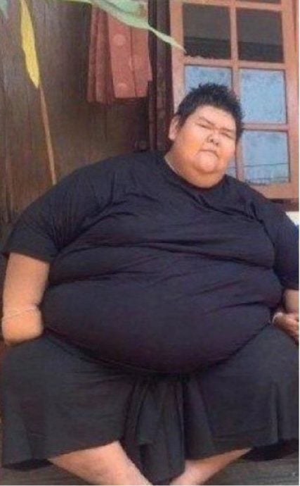 210kg大胖子救伤车载不了!呼吸衰竭后身亡