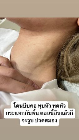 BL剧男星Pawin遭控家暴 女友​腿被打断窒息送医