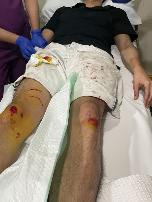 商人面交被抢劫被砍伤