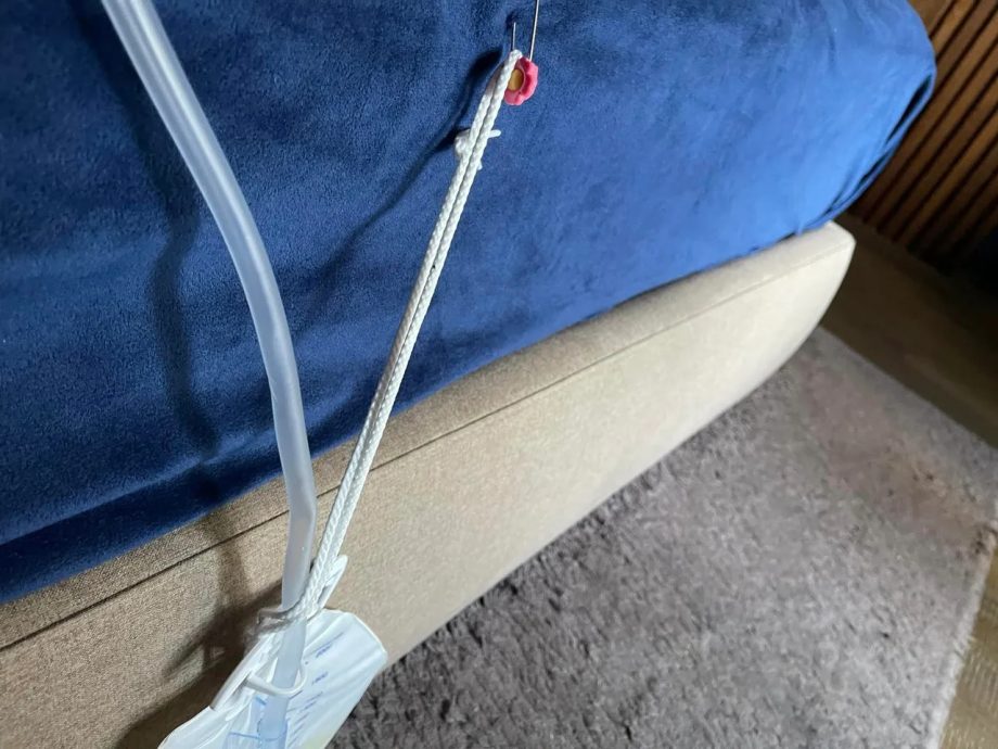 孙德荣尿不出紧急开刀 “别集气！上天让我活我就活”