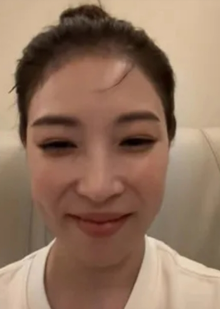 客串《我老公》肿唇抢戏 宝儿直播解画修脸疑云