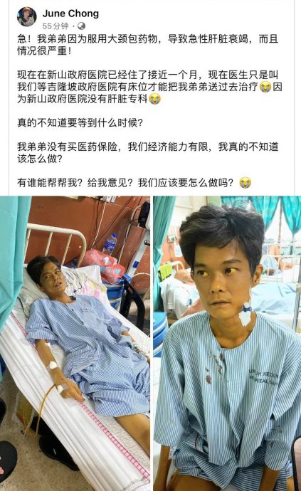 **已签发**柔：一次“大颈包”，竟变成肝衰竭