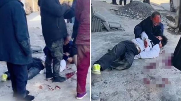  拒到继母家拜年　少年被生父暴打至头破血流 