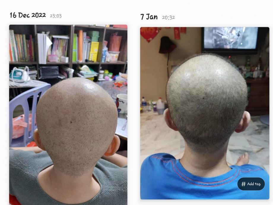 暖势力:患上不治之症的补习老师王绣钰