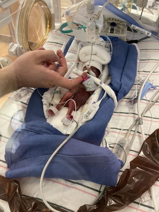 研究：美国约一成早产案例同塑料品化学物质有关