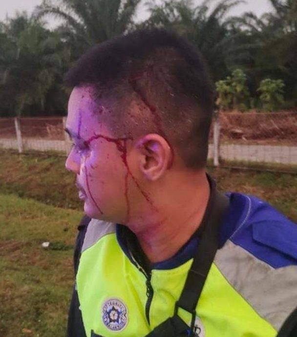 追可疑车被丢硬物击中挡风镜 巡逻车撞毁2警员受伤