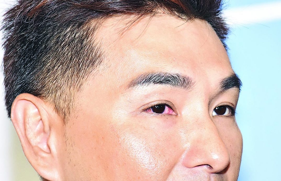 陈展鹏被女儿误伤眼 罗子溢禁子女看《婚后事》