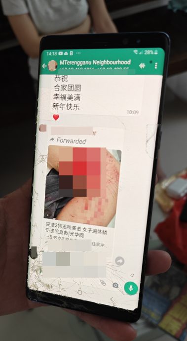 （大北马）华裔妇女被3恶犬噬咬，过年每天折返医院洗伤口