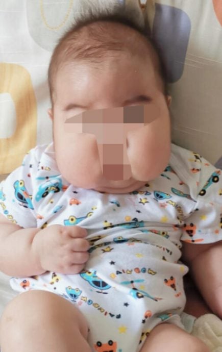 (已签发)柔:狮城二三事:网售“天然”星星膏 致男婴类固醇中毒
