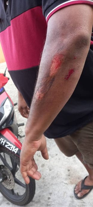 *已签发*柔:疑油槽车溢油至路面,逾3摩托车滑倒