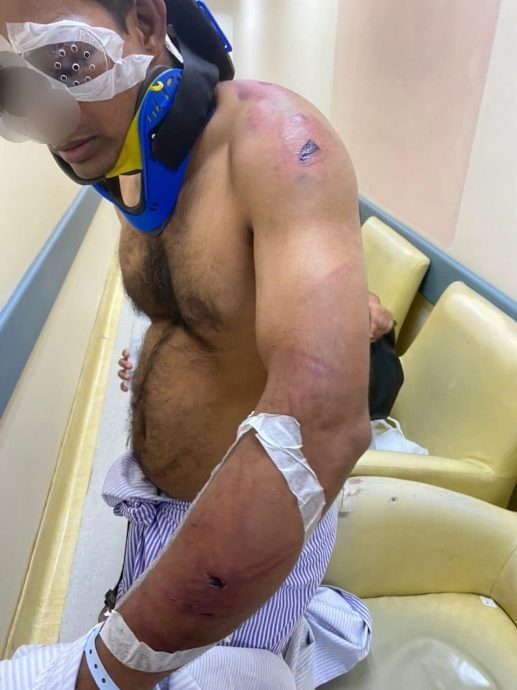 戒毒者遭殴打 左眼被打瞎!警方捕2员工助查